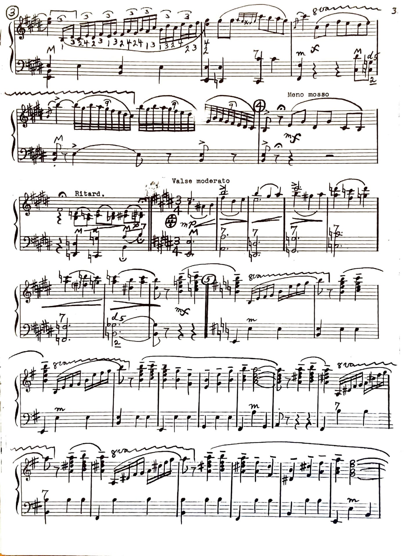 French Medley (Solo)